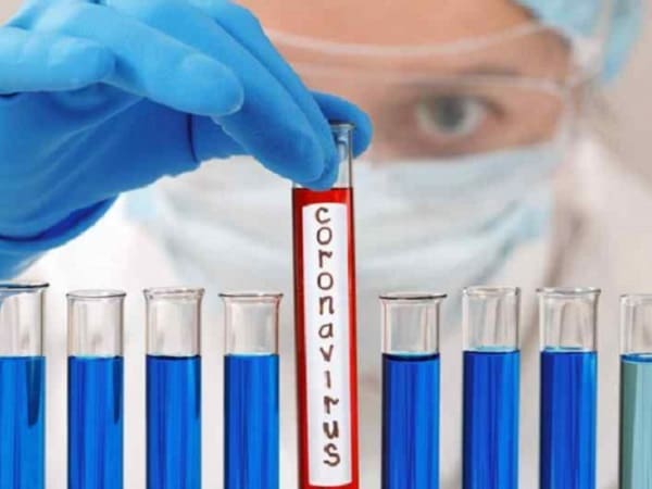 Rabotodatel Ne Vprave Obyazat Rabotnikov Projti Test Na Koronavirus